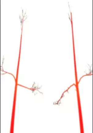 Lilith`s Cord Ch.0-26