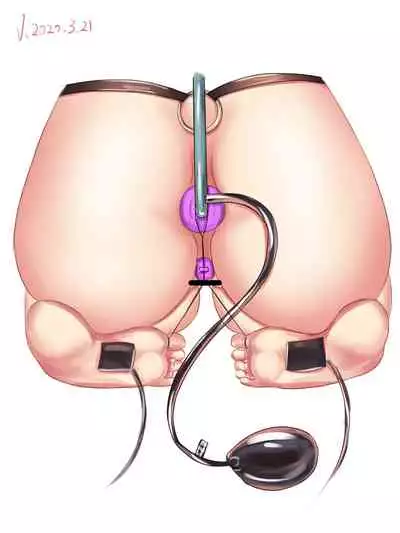 [Pixiv] VV__SXX 58170013